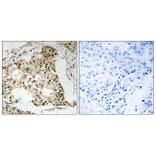 Immunohistochemistry - Anti-Retinoic Acid Receptor alpha (phospho Ser77) Antibody (A8217) - Antibodies.com