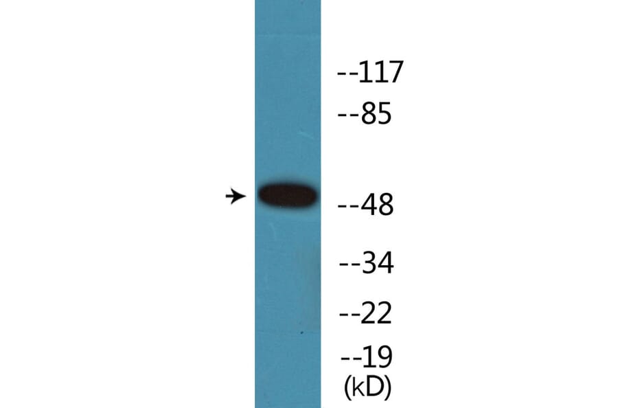Western Blot - Anti-Retinoic Acid Receptor alpha (phospho Ser77) Antibody (P12-1171) - Antibodies.com