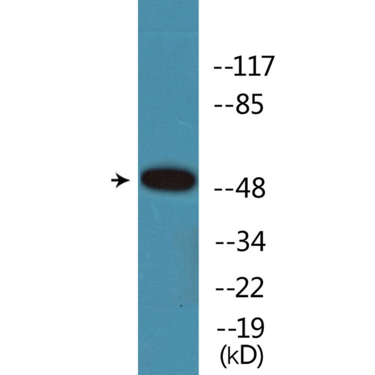 Western Blot - Anti-Retinoic Acid Receptor alpha (phospho Ser77) Antibody (P12-1171) - Antibodies.com