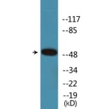 Western Blot - Anti-Retinoic Acid Receptor alpha (phospho Ser77) Antibody (P12-1171) - Antibodies.com
