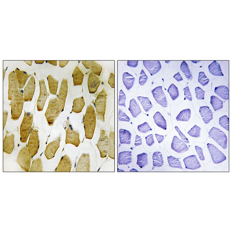 Immunohistochemistry - Anti-Arachidonate 5 Lipoxygenase (phospho Ser271) Antibody (A0769) - Antibodies.com
