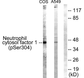 Western Blot - Anti-Neutrophil Cytosol Factor 1 (phospho Ser304) Antibody (A1160) - Antibodies.com