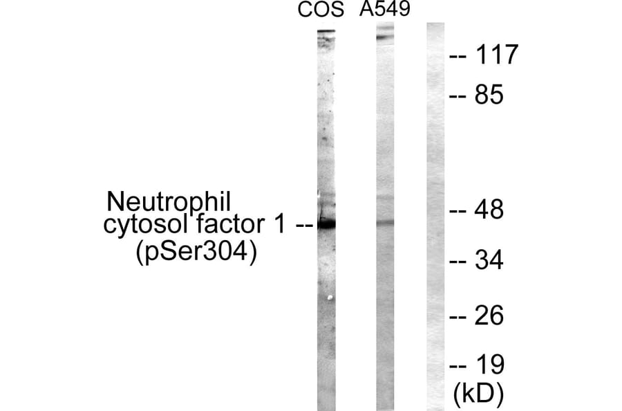 Western Blot - Anti-Neutrophil Cytosol Factor 1 (phospho Ser304) Antibody (A1160) - Antibodies.com