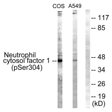 Western Blot - Anti-Neutrophil Cytosol Factor 1 (phospho Ser304) Antibody (A1160) - Antibodies.com