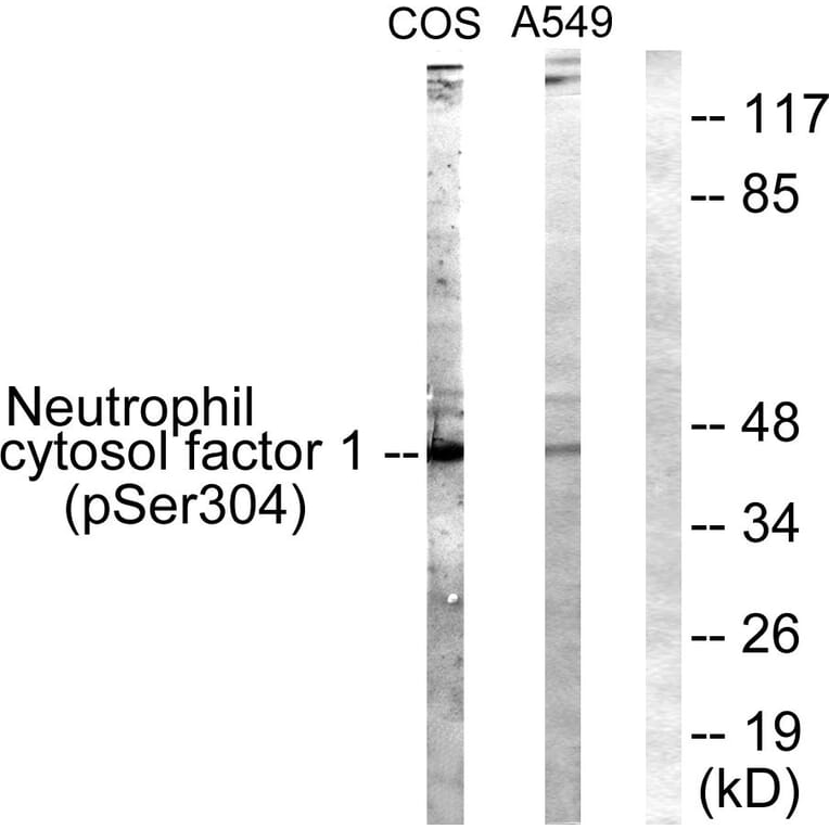 Western Blot - Anti-Neutrophil Cytosol Factor 1 (phospho Ser304) Antibody (A1160) - Antibodies.com