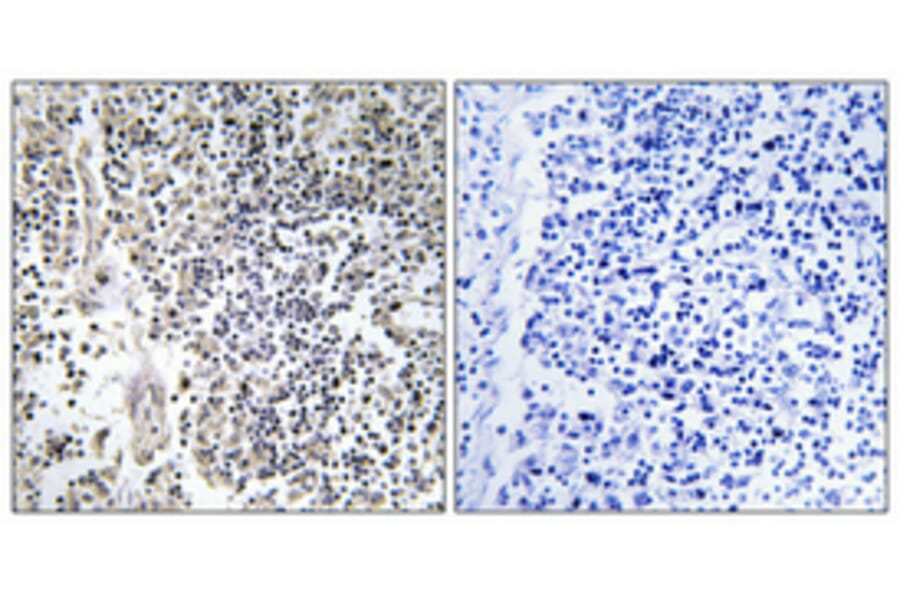 Immunohistochemistry - Anti-Neutrophil Cytosol Factor 1 (phospho Ser304) Antibody (A1160) - Antibodies.com