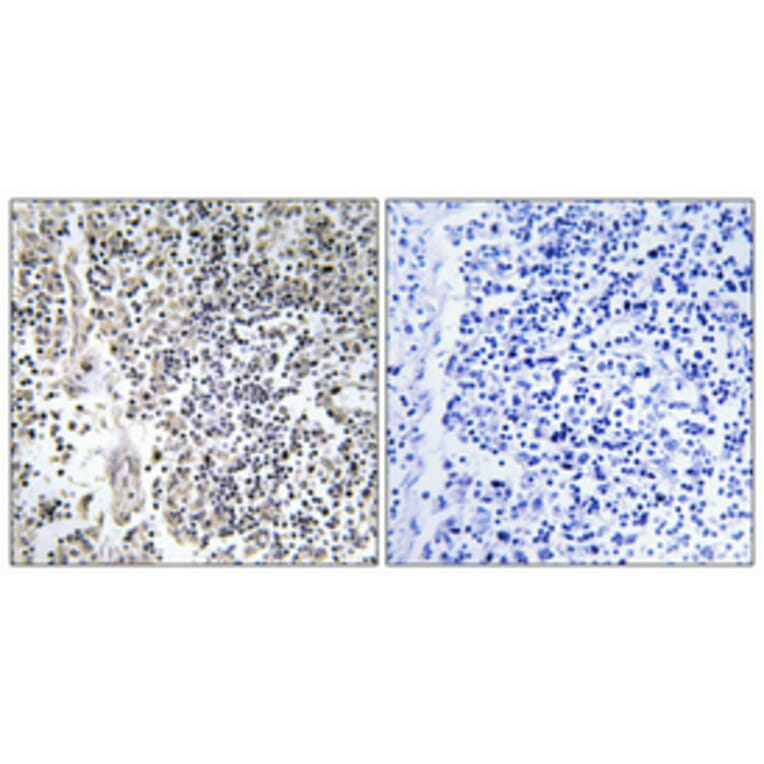 Immunohistochemistry - Anti-Neutrophil Cytosol Factor 1 (phospho Ser304) Antibody (A1160) - Antibodies.com