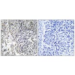Immunohistochemistry - Anti-Neutrophil Cytosol Factor 1 (phospho Ser304) Antibody (A1160) - Antibodies.com