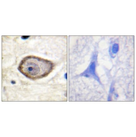 Immunohistochemistry - Anti-Coagulation Factor III (phospho Ser290) Antibody (A0873) - Antibodies.com