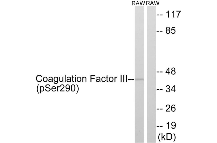 Western Blot - Anti-Coagulation Factor III (phospho Ser290) Antibody (A0873) - Antibodies.com
