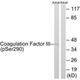 Western Blot - Anti-Coagulation Factor III (phospho Ser290) Antibody (A0873) - Antibodies.com