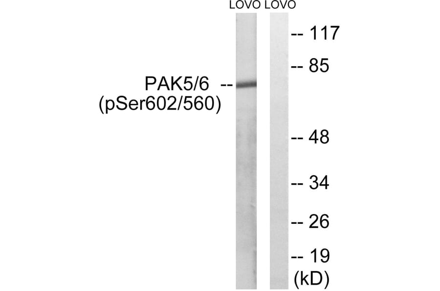Western Blot - Anti-PAK5 + PAK6 (phospho Ser602 + Ser560) Antibody (A8394) - Antibodies.com