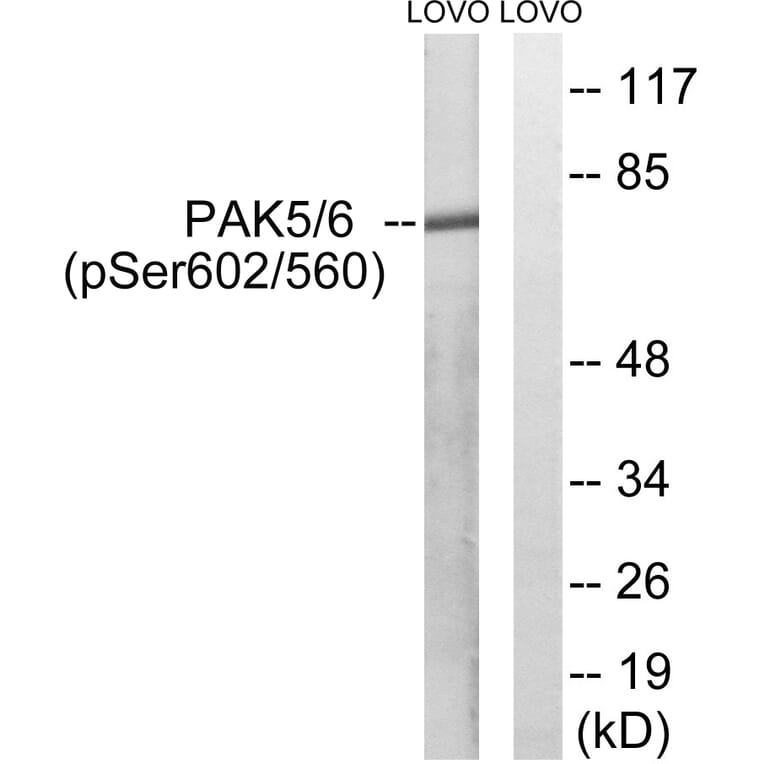 Western Blot - Anti-PAK5 + PAK6 (phospho Ser602 + Ser560) Antibody (A8394) - Antibodies.com
