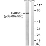 Western Blot - Anti-PAK5 + PAK6 (phospho Ser602 + Ser560) Antibody (A8394) - Antibodies.com