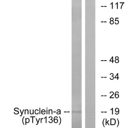 Western Blot - Anti-Synuclein-alpha (phospho Tyr136) Antibody (A7236) - Antibodies.com