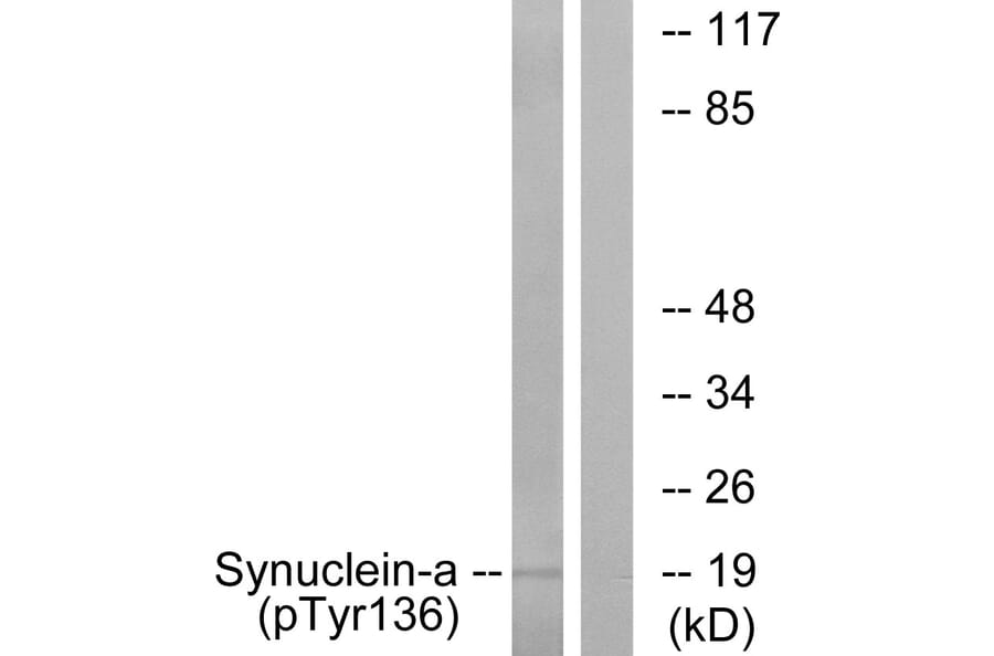 Western Blot - Anti-Synuclein-alpha (phospho Tyr136) Antibody (A7236) - Antibodies.com