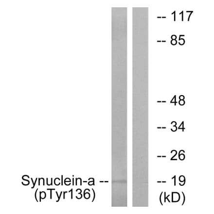 Western Blot - Anti-Synuclein-alpha (phospho Tyr136) Antibody (A7236) - Antibodies.com