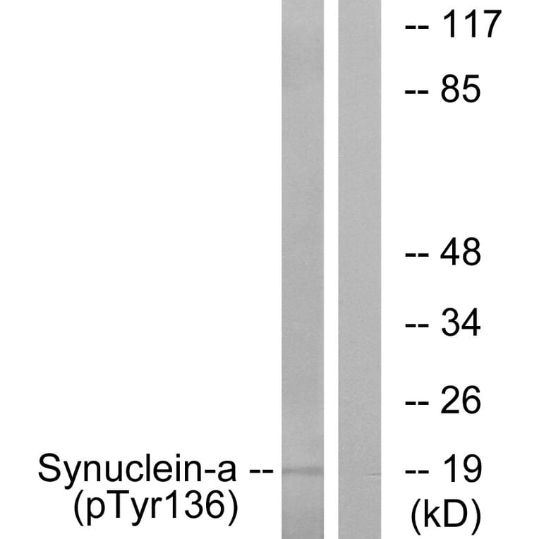 Western Blot - Anti-Synuclein-alpha (phospho Tyr136) Antibody (A7236) - Antibodies.com