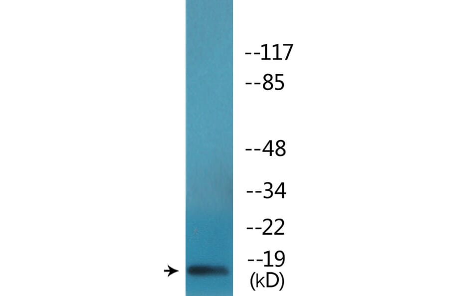 Western Blot - Anti-Synuclein-alpha (phospho Tyr136) Antibody (P12-1184) - Antibodies.com