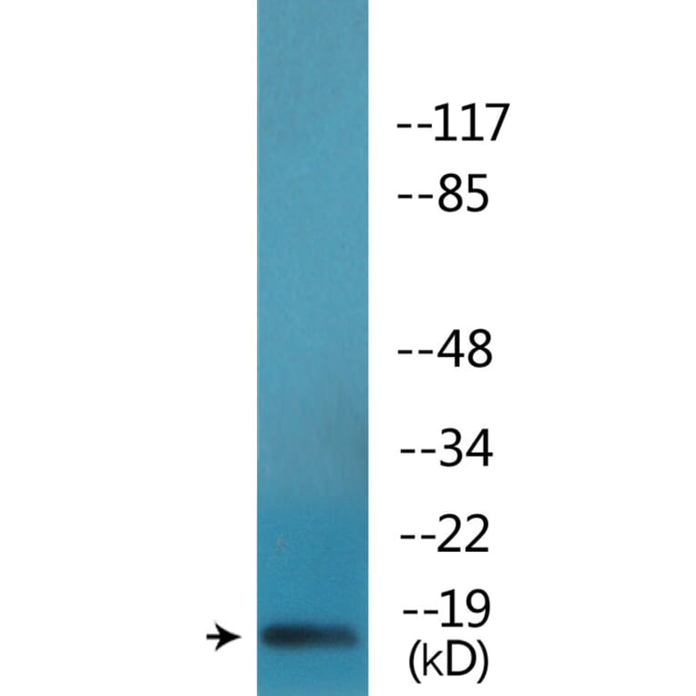 Western Blot - Anti-Synuclein-alpha (phospho Tyr136) Antibody (P12-1184) - Antibodies.com