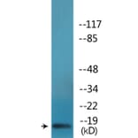 Western Blot - Anti-Synuclein-alpha (phospho Tyr136) Antibody (P12-1184) - Antibodies.com