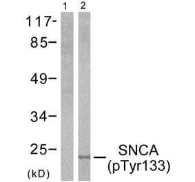 Western Blot - Anti-Synuclein-alpha (phospho Tyr133) Antibody (A7235) - Antibodies.com