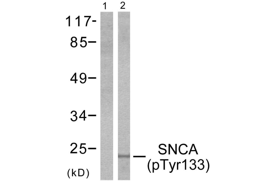 Western Blot - Anti-Synuclein-alpha (phospho Tyr133) Antibody (A7235) - Antibodies.com