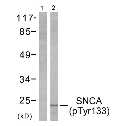 Western Blot - Anti-Synuclein-alpha (phospho Tyr133) Antibody (A7235) - Antibodies.com