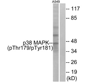 Western Blot - Anti-p38 MAPK (phospho Thr179+Tyr181) Antibody (A0799) - Antibodies.com