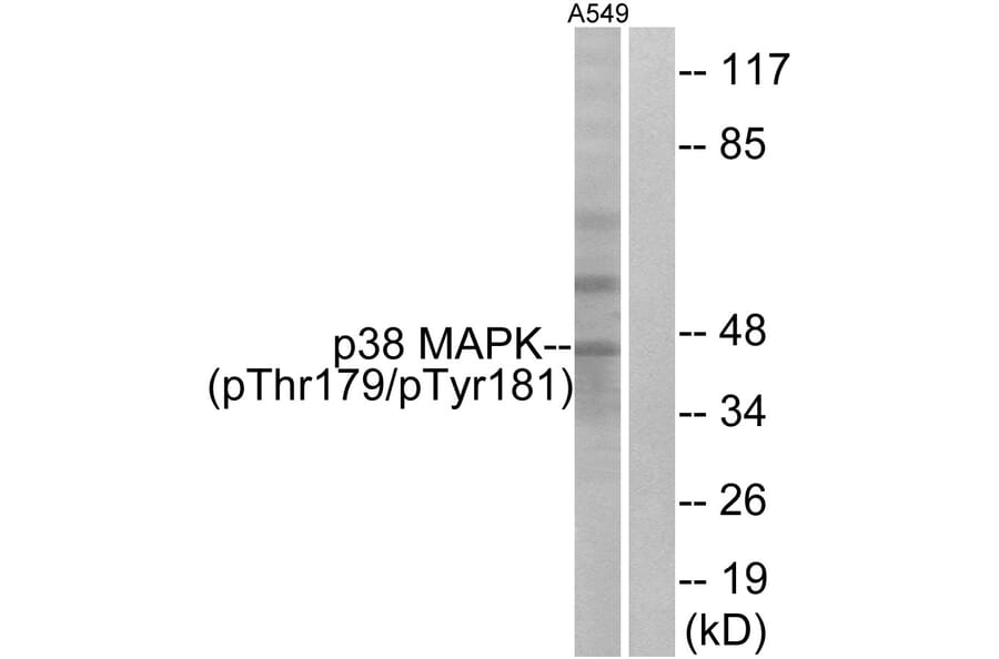 Western Blot - Anti-p38 MAPK (phospho Thr179+Tyr181) Antibody (A0799) - Antibodies.com