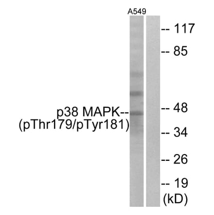 Western Blot - Anti-p38 MAPK (phospho Thr179+Tyr181) Antibody (A0799) - Antibodies.com