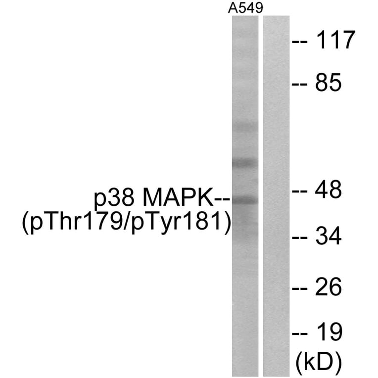 Western Blot - Anti-p38 MAPK (phospho Thr179+Tyr181) Antibody (A0799) - Antibodies.com