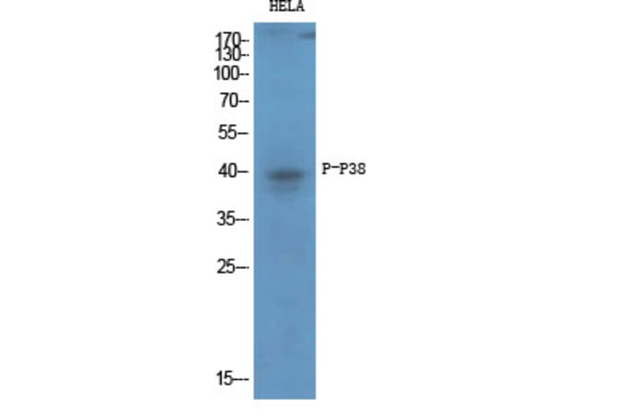 Western Blot - Anti-p38 MAPK (phospho Thr179+Tyr181) Antibody (A0799) - Antibodies.com