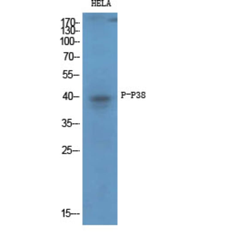 Western Blot - Anti-p38 MAPK (phospho Thr179+Tyr181) Antibody (A0799) - Antibodies.com