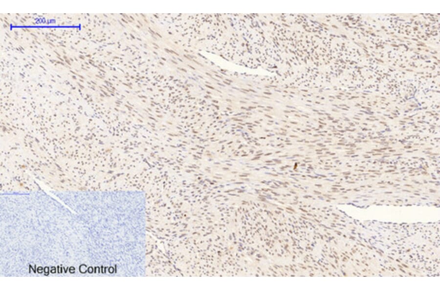 Immunohistochemistry - Anti-p38 MAPK (phospho Thr179+Tyr181) Antibody (A0799) - Antibodies.com