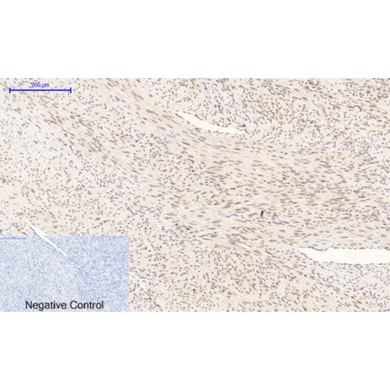 Immunohistochemistry - Anti-p38 MAPK (phospho Thr179+Tyr181) Antibody (A0799) - Antibodies.com