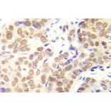 Immunohistochemistry - Anti-HDAC1 (phospho Ser421 + Ser423) Antibody (P12-1026) - Antibodies.com