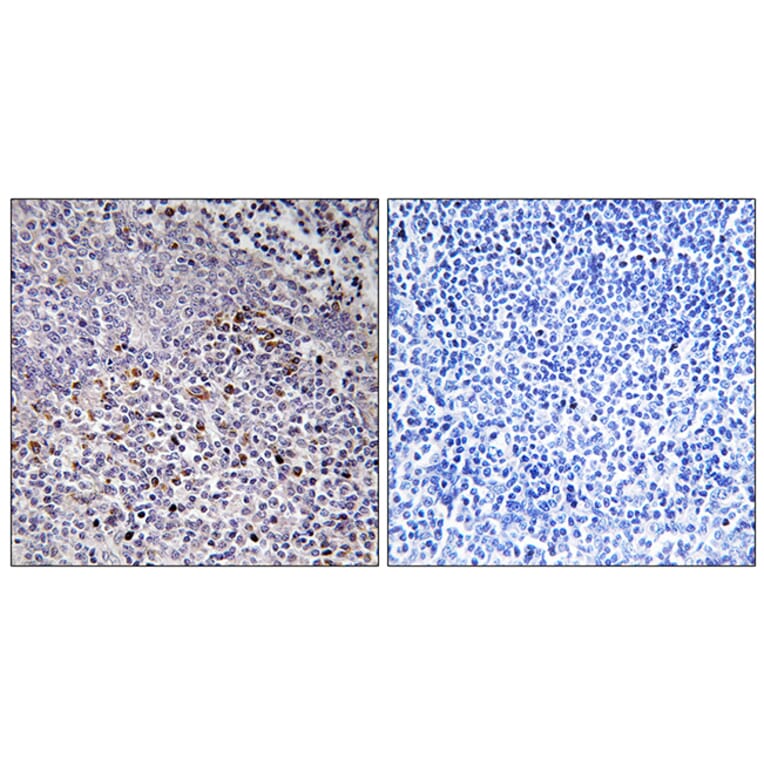 Immunohistochemistry - Anti-Cytochrome c-type Heme Lyase Antibody (C12123) - Antibodies.com