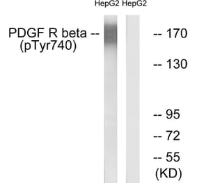 Western Blot - Anti-PDGFR beta (phospho Tyr740) Antibody (A0970) - Antibodies.com