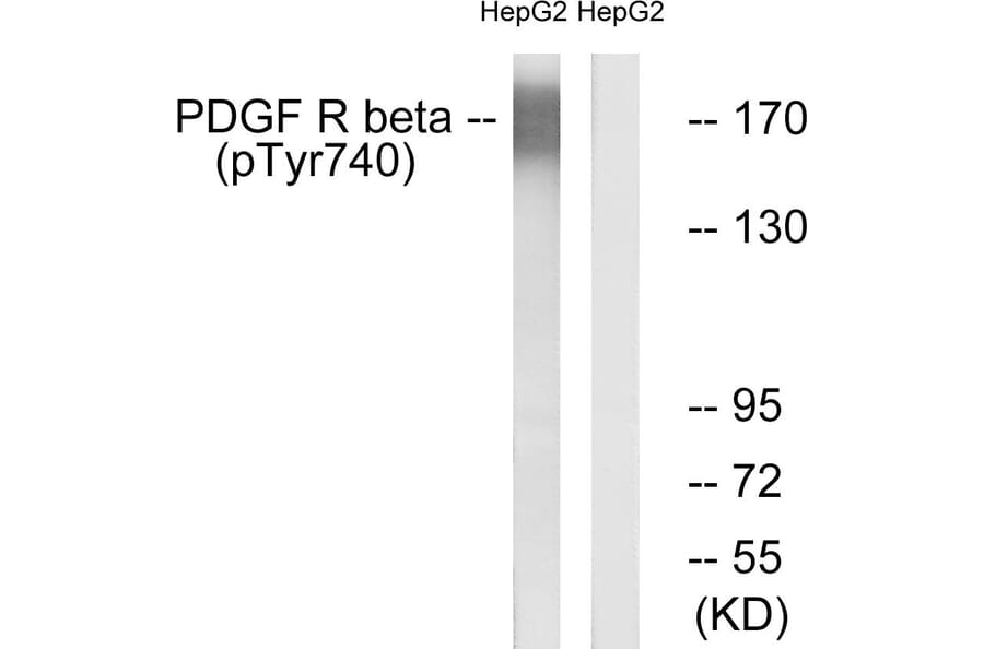Western Blot - Anti-PDGFR beta (phospho Tyr740) Antibody (A0970) - Antibodies.com