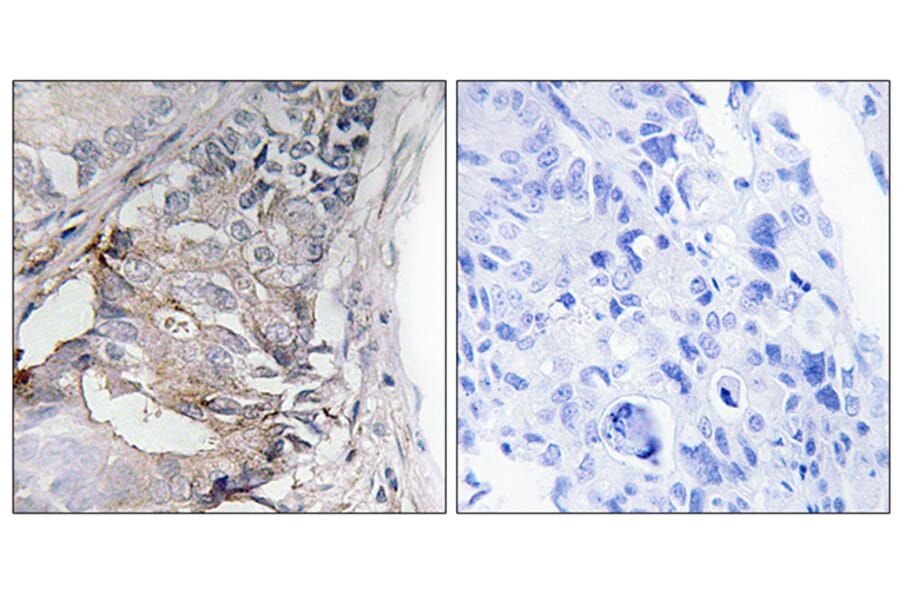 Immunohistochemistry - Anti-PDGFR beta (phospho Tyr740) Antibody (A0970) - Antibodies.com