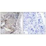 Immunohistochemistry - Anti-PDGFR beta (phospho Tyr740) Antibody (A0970) - Antibodies.com