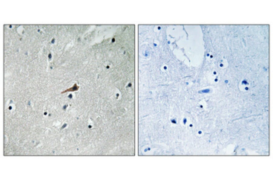 Immunohistochemistry - Anti-PDGFR beta (phospho Tyr740) Antibody (A0970) - Antibodies.com