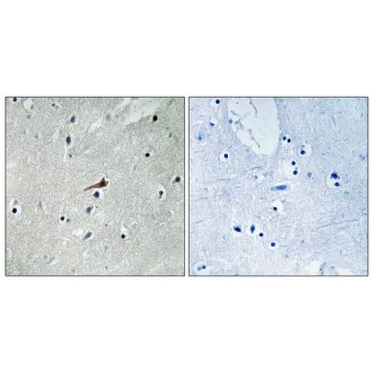 Immunohistochemistry - Anti-PDGFR beta (phospho Tyr740) Antibody (A0970) - Antibodies.com