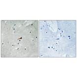 Immunohistochemistry - Anti-PDGFR beta (phospho Tyr740) Antibody (A0970) - Antibodies.com