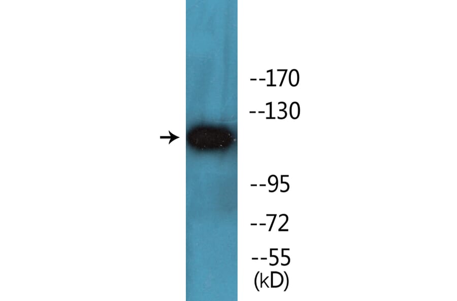 Western Blot - Anti-PDGFR beta (phospho Tyr740) Antibody (P12-1162) - Antibodies.com