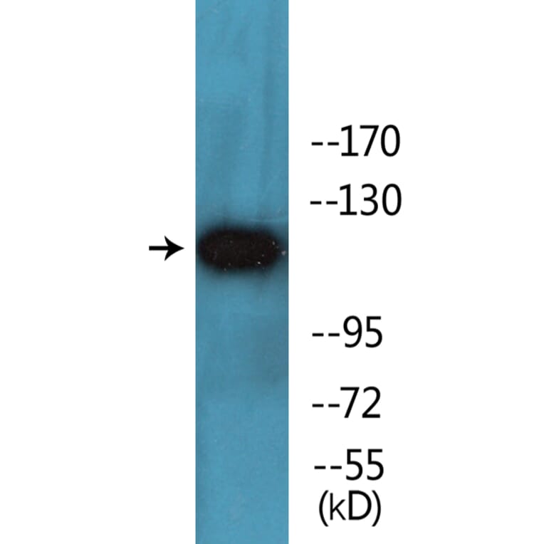 Western Blot - Anti-PDGFR beta (phospho Tyr740) Antibody (P12-1162) - Antibodies.com