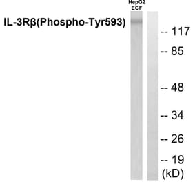 Western Blot - Anti-IL-3R beta (phospho Tyr593) Antibody (A0444) - Antibodies.com