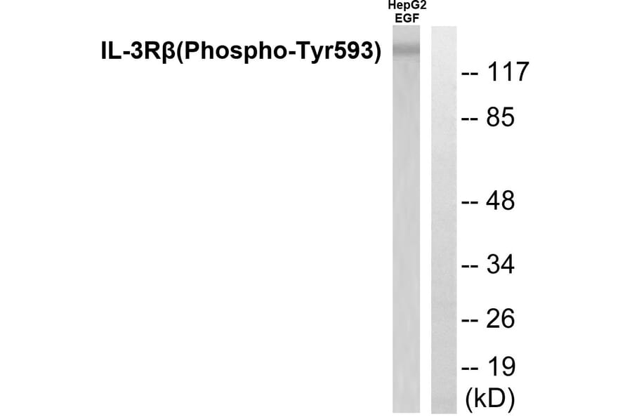 Western Blot - Anti-IL-3R beta (phospho Tyr593) Antibody (A0444) - Antibodies.com