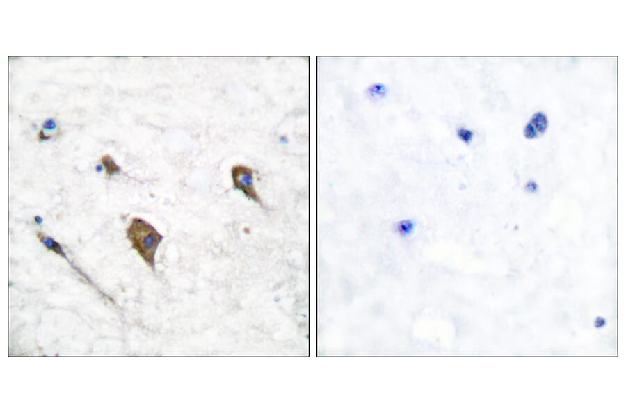 Immunohistochemistry - Anti-IL-3R beta (phospho Tyr593) Antibody (A0444) - Antibodies.com